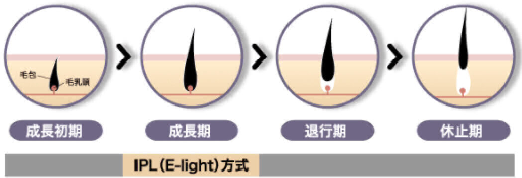 成長