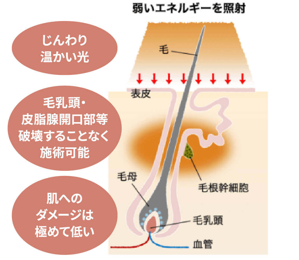 弱いエネルギーを照射